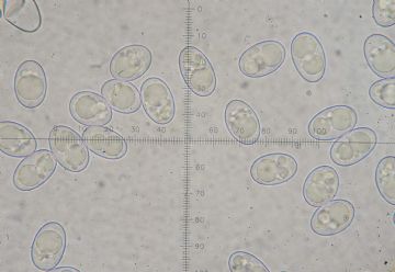 Octospora humosa-ascosporas (Autor: Augusto Calzada ) 
