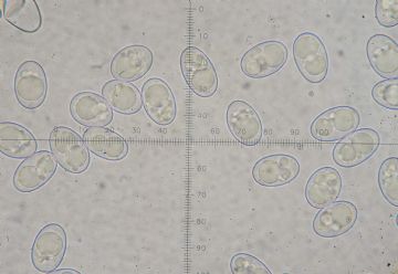 Octospora humosa-ascosporas (Autor: Augusto Calzada ) 