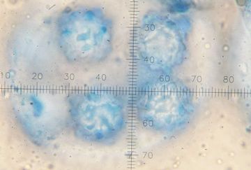 Terfezia claveryi-ascosporas teñidas con Azul de algodón (Autor : Augusto Calzada )