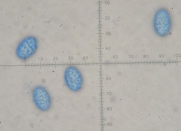 Scutellinia crinita -Ascosporas (Autor : Augusto Calzada )