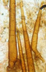Scutellinia crinita-Pelos del margen (Autor : Augusto Calzada )
