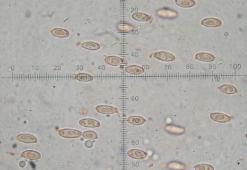 Leucoagaricus purpureolilacinus -esporas( Autor: Augusto Calzada )