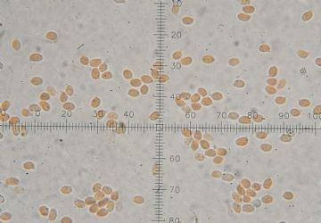 Rhizocybe vermicularis-esporas ( Autor : Augusto Calzada )