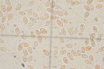 Leucoagaricus pseudopilatianus-esporas (Autor : Augusto Calzada )