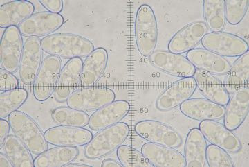 Anthracobia macrocystis-Ascosporas ( Autor : Augusto Calzada)