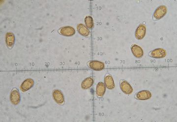 Ganoderm adspersum-esporas ( Autor: Augusto Calzada )