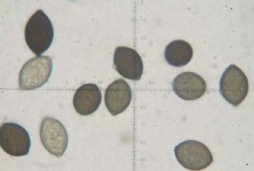Microthecium zobelii (Melaspora zobelii) ascosporas ( Autor : Augusto Calzada )