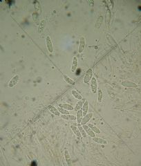 Discinella boudieri -ascosporas (Autor : Herminio Prez )