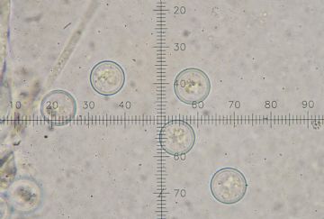 Plicaria endocarpoides-Ascosporas (Autor : Augusto Calzada)