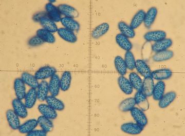 Sowerbyella radicullata-Ascosporas (Autor : Augusto Calzada )