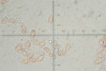 Squamanita paradoxa (Dissoderma paradoxum) Esporas - (Autor: Augusto Calzada )