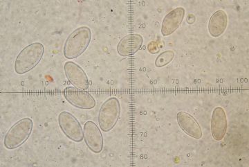 Geopyxis majalis-ascosporas (Autor: augusto Calzada)