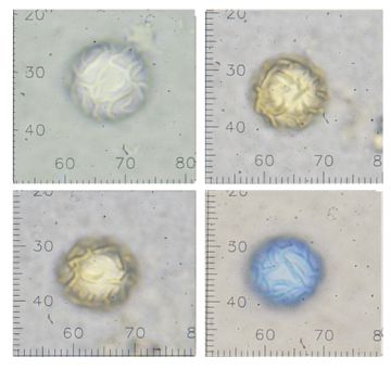 Lamprospora aberrans-ascosporas ( Autor : Augusto Calzada )