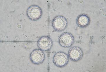 Lamprospora aberrans-ascosporas H2O ( Autor : Augusto Calzada )