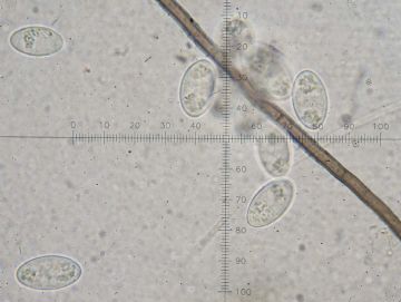 Strobiloscypha cupressina-ascosporas ( Autor: Augusto Calzada )