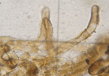 Strobiloscypha cupressina-pelos exterior apotecio ( Autor: Augusto Calzada )