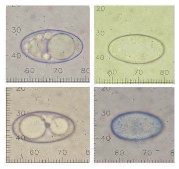 Neottiella aphanodictyon-ascosporas ( Autor: Augusto Calzada )