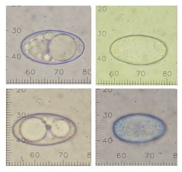 Neottiella aphanodictyon-ascosporas ( Autor: Augusto Calzada )