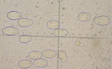 Neottiella aphanodictyon-ascosporas H2O ( Autor: Augusto Calzada )