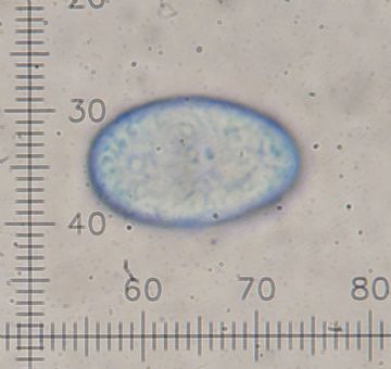 Neottiella aphanodictyon-ornamentacin ascosporas ( Autor: Augusto Calzada )