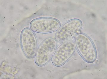 Boubovia ascoboloides-ascosporas ( Autor: Augusto Calzada )