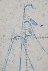 Boubovia ascoboloides-parfisis ( Autor: Augusto Calzada )
