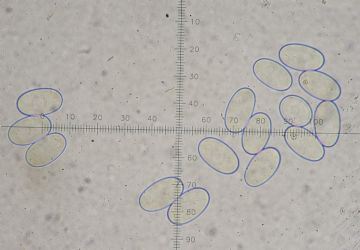 Byssonectria deformis-ascosporas ( Autor: Augusto Calzada )
