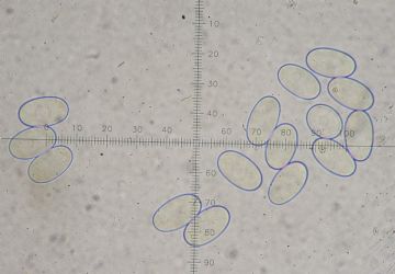 Byssonectria deformis-ascosporas ( Autor: Augusto Calzada )