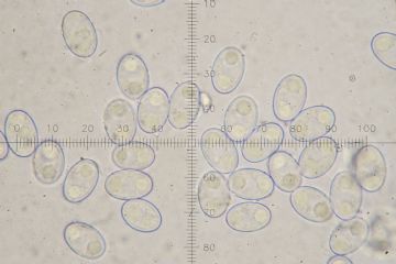 Geoscypha violacea-Ascosporas (Autor: Augusto Calzada)