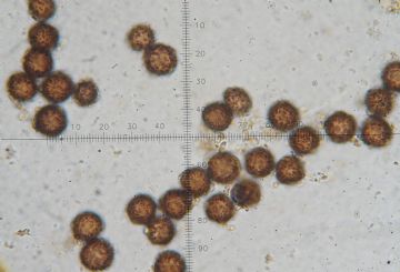 Scleroderma areolatum-esporas ( Autor : Augusto Calzada)