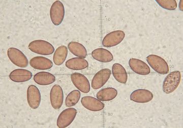 Protostropharia lueonitens-Esporas (Autor : Augusto Calzada )