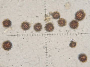 Scleroderma bovista -Esporas ( Autor : Augusto Calzada )