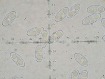 Anthracobia melaloma-Ascosporas ( Autor: Augusto Calzada )