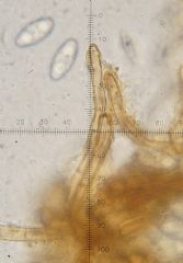 Anthracobia melaloma-Pelos margen ( Autor: Augusto Calzada )