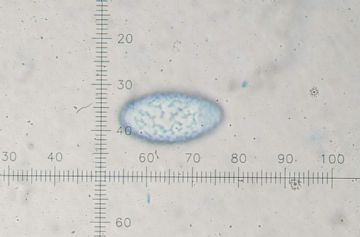 Neottiella rutilans-ornamentacin ascospora (Autor : Augusto Calzada)