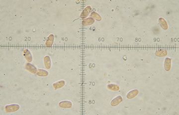 Lepiota griseovirens-basidiosporas (  Autor: Augusto Calzada)