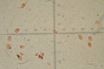 Lepiota ochraceofulva-basidiosporas (  Autor: Augusto Calzada)