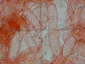 Sarcoscypha coccinea-ascosporas (Autor: Augusto Calzada)