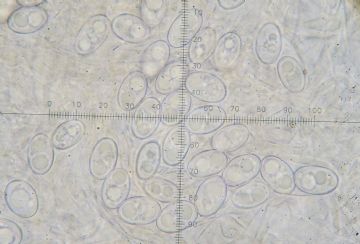 Chaetothiersia cupressicola-ascosporas (Autor : Augusto Calzada)