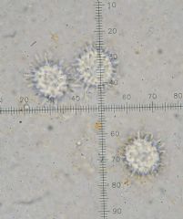 Ramsbottomia macrantha -Ascosporas ( Autor : Augusto Calzada )