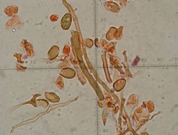 Ganoderma applanatum -Hifas trimticas ( Autor : Augusto Calzada )