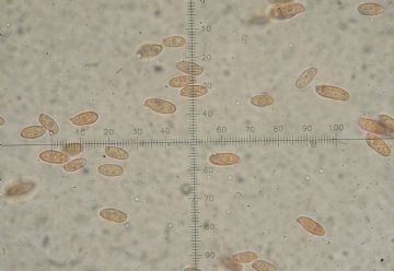 Suillus mediterraneensis-Esporas ( Autor: Augusto Calzada )