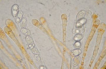 Octospora humosa -Ascas y parfisis( Autor: Augusto Calzada )