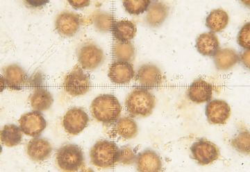 Scleroderma cepa -Esporas ( Autor: Augusto Calzada )