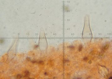 Psathyrella pennata-Queilocistidios ( Autor: Augusto Calzada )