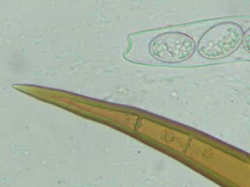 Scutellinia setosa-terminación pelo (Autor: Felipe Alonso)