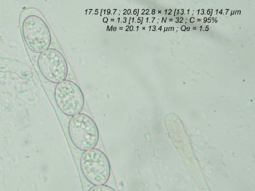 Scutellinia setosa-ascosporas (Autor: Felipe Alonso)