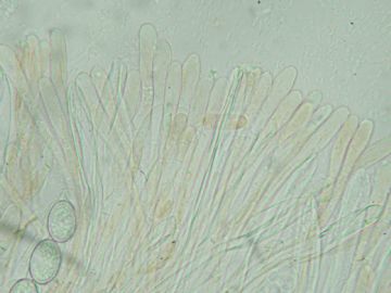 Scutellinia setosa-Parafisis (Felipe Alonso)