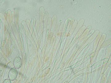 Scutellinia setosa-Parafisis (Felipe Alonso)