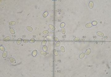 Leucoagaricus griseodiscus-esporas ( Autor : Augusto Calzada )